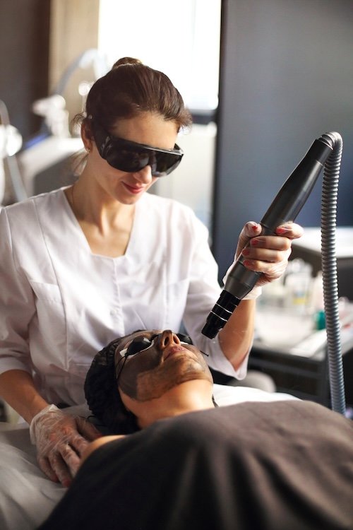 carbon peel in thane