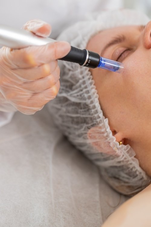 microneedling in thane
