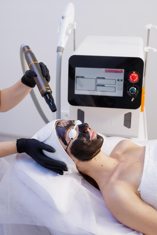 Pico-Hollywood Carbon Peel Treatment in Thane
