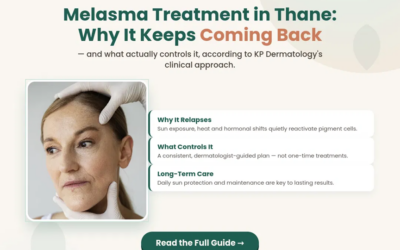 Melasma Treatment in Thane: Why It Keeps Coming Back and What Actually Controls It