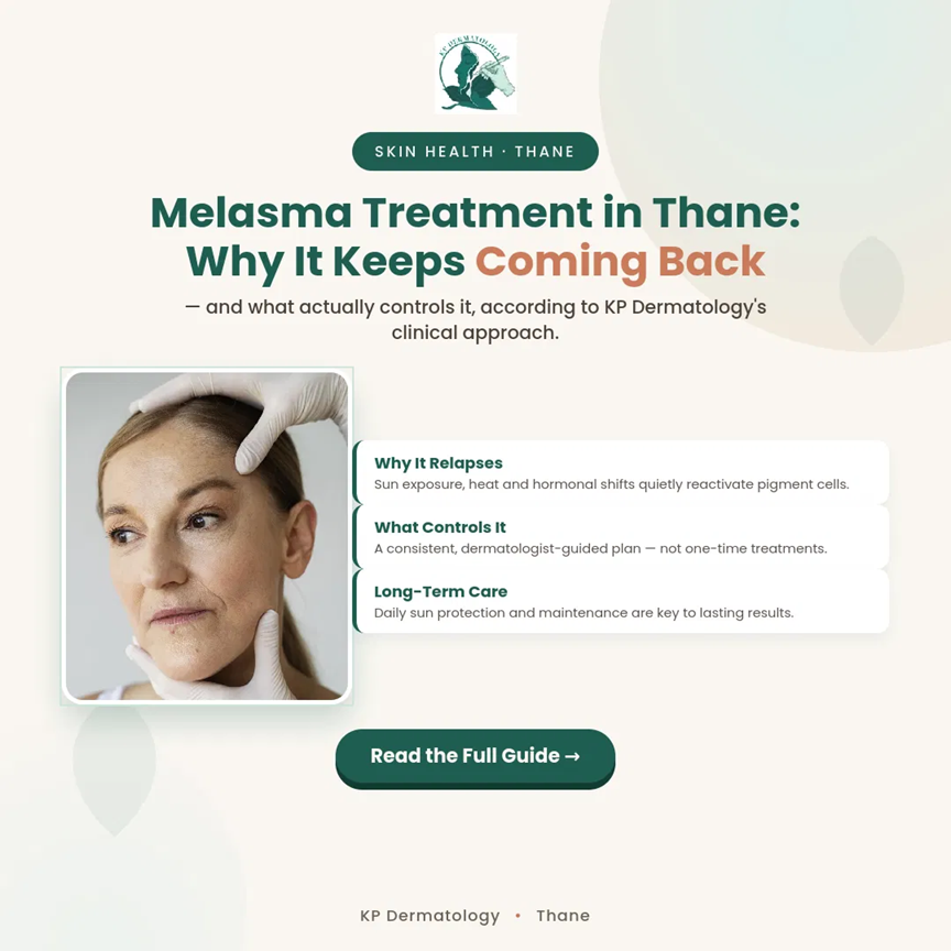 Melasma Treatment in Thane: Why It Keeps Coming Back and What Actually Controls It