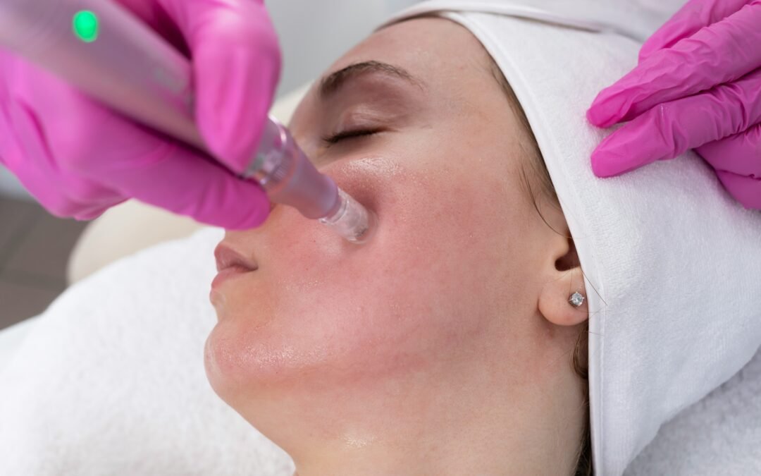 Pigmentation Disorders: Causes, Types and How Dermatologists Treat Them
