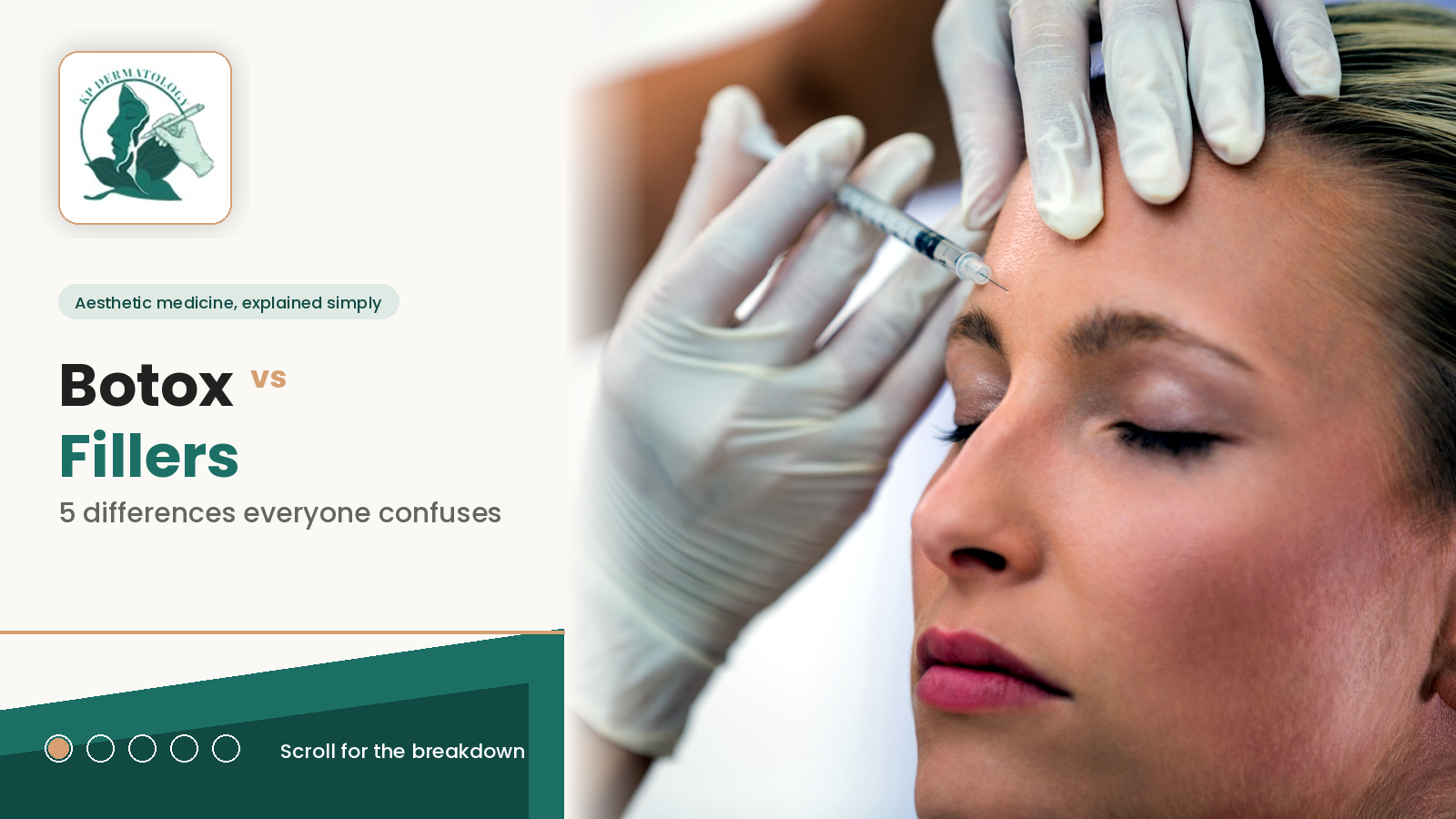 Botox vs Fillers: 5 Differences Everyone Confuses