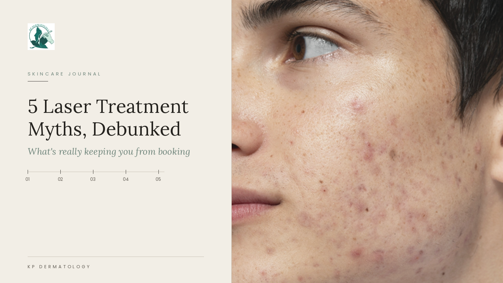 5 Laser Treatment Myths That Keep People From Booking